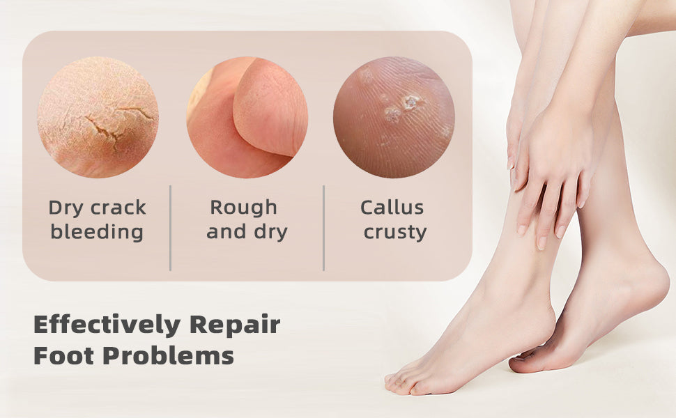 Gel Spa Moisturizing Socks for Cracked Heels | Soft Repair Socks | Deep Hydrating Foot Care for Men & Women